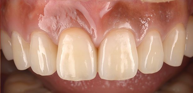 加工後の写真(右側の写真)