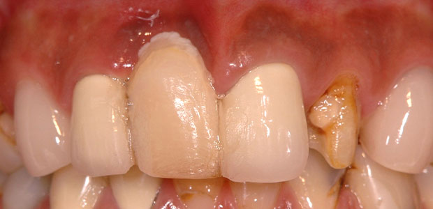 加工前の写真(左側の写真)