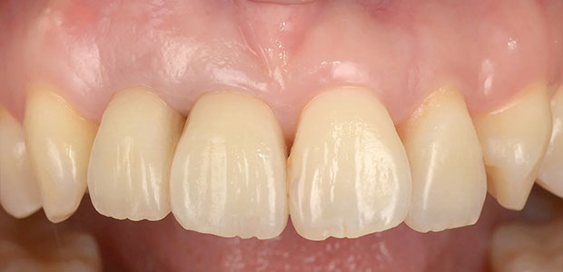 加工後の写真(右側の写真)