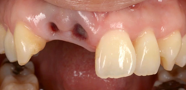 加工前の写真(左側の写真)