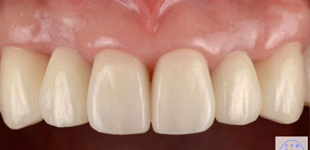 加工後の写真(右側の写真)