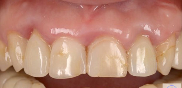 加工前の写真(左側の写真)